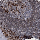 Immunohistochemical staining of human tonsil shows strong cytoplasmic positivity in germinal center cells.