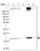 Lane 1: Marker [kDa] 250, 130, 95, 72, 55, 36, 28, 17, 10_br/_Lane 2: Human cell line RT-4_br/_Lane 3: Human cell line U-251MG sp_br/_Lane 4: Human plasma (IgG/HSA depleted)_br/_Lane 5: Human liver tissue_br/_Lane 6: Human tonsil tissue