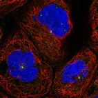 Immunofluorescent staining of human cell line A-431 shows localization to nucleoli fibrillar center, cytosol & centrosome.