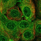 Immunofluorescent staining of human cell line MCF7 shows localization to nucleoplasm, nuclear membrane & endoplasmic reticulum.
