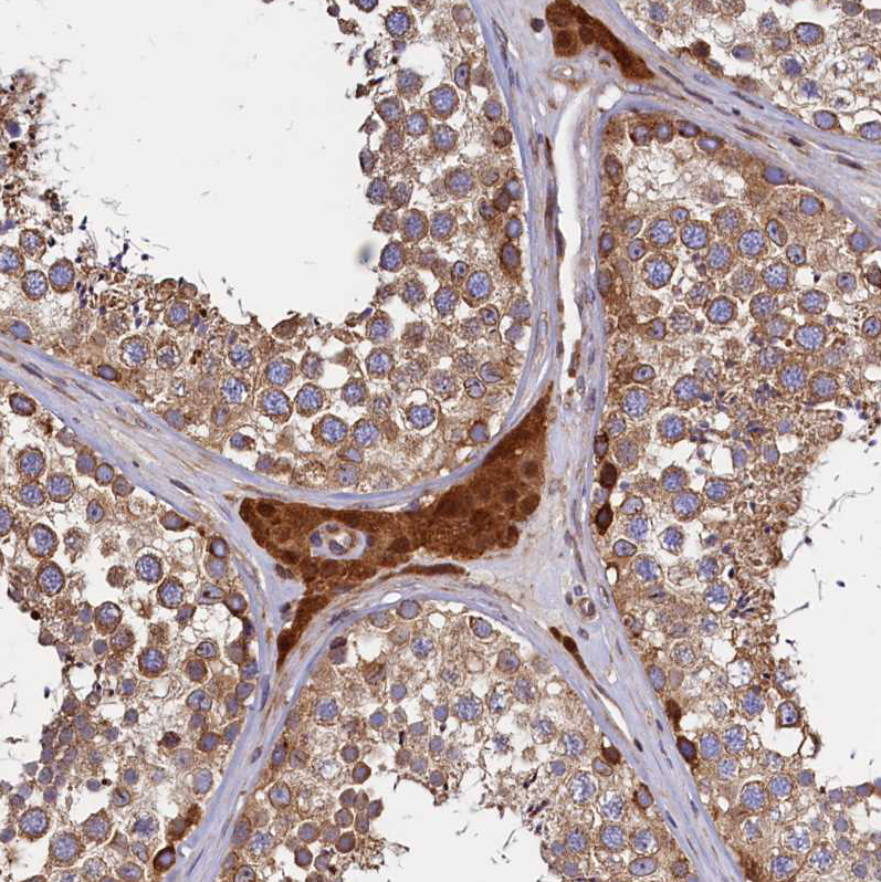 Anti-ATXN2L Antibody