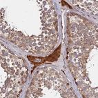 Anti-ATXN2L Antibody