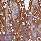 Immunohistochemical staining of human duodenum shows strong cytoplasmic positivity in glandular cells.