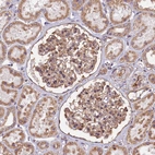 Immunohistochemical staining of human kidney shows moderate cytoplasmic positivity in cells in glomeruli.