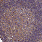 Immunohistochemical staining of human tonsil shows weak to moderate cytoplasmic positivity in germinal center cells.