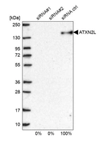 Western blot analysis in U2OS cells transfected with control siRNA, target specific siRNA probe #1 and #2, using Anti-ATXN2L antibody. Remaining relative intensity is presented.