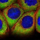 Immunofluorescent staining of human cell line A-431 shows localization to cytosol.