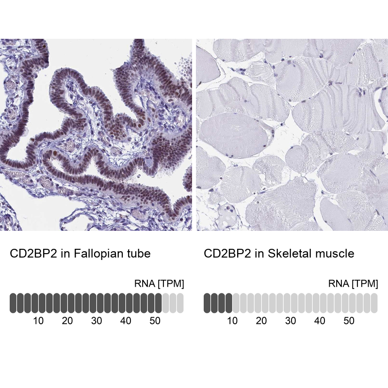 Anti-CD2BP2 Antibody
