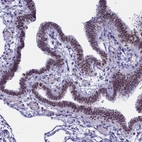 Immunohistochemical staining of human fallopian tube shows high expression.