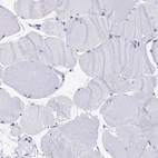Immunohistochemical staining of human skeletal muscle shows low expression as expected.