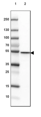 Lane 1: Marker [kDa] 250, 130, 100, 70, 55, 35, 25, 15, 10_br/_Lane 2: Human cell line MCF-7