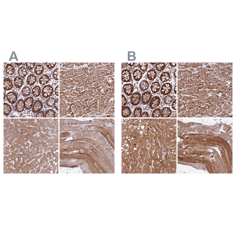 Anti-NDUFA8 Antibody