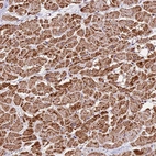 Immunohistochemical staining of human heart muscle shows strong granular cytoplasmic positivity in cardiomyocytes.