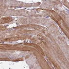 Immunohistochemical staining of human skeletal muscle shows strong granular cytoplasmic positivity in myocytes.