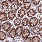 Immunohistochemical staining of human colon shows strong granular cytoplasmic positivity in glandular cells.