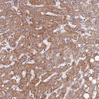 Immunohistochemical staining of human liver shows strong granular cytoplasmic positivity in hepatocytes.
