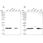Western blot analysis using Anti-NDUFA8 antibody HPA041510 (A) shows similar pattern to independent antibody HPA041600 (B).