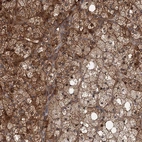 Immunohistochemical staining of human adrenal gland shows moderate to strong cytoplasmic positivity in glandular cells.