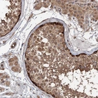 Immunohistochemical staining of human testis shows moderate to strong cytoplasmic positivity in cells in seminiferous ducts.