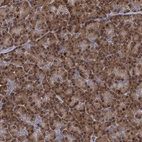Anti-RNF125 Antibody