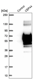 Western blot analysis in control (vector only transfected HEK293T lysate) and CEP44 over-expression lysate (Co-expressed with a C-terminal myc-DDK tag (~3.1 kDa) in mammalian HEK293T cells, LY421699).