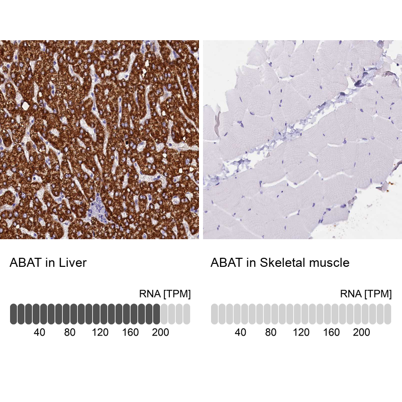 Anti-ABAT Antibody