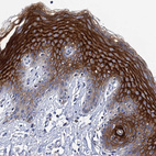 Immunohistochemical staining of human skin shows strong membranous positivity in squamous epithelial cells.