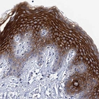 Immunohistochemical staining of human skin shows strong membranous positivity in squamous epithelial cells.