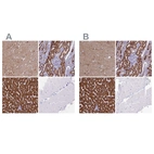 Immunohistochemical staining of human cerebral cortex, kidney, liver and skeletal muscle using Anti-ABAT antibody HPA041528 (A) shows similar protein distribution across tissues to independent antibody HPA041690 (B).