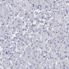 Anti-LYPD3 Antibody