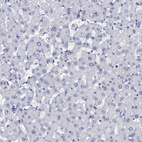 Immunohistochemical staining of human liver shows no positivity in hepatocytes as expected.