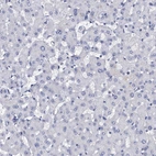 Immunohistochemical staining of human liver shows no positivity in hepatocytes as expected.