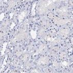 Immunohistochemical staining of human kidney shows no positivity in cells in tubules as expected.