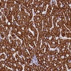 Immunohistochemical staining of human liver shows strong granular cytoplasmic positivity in hepatocytes.
