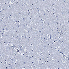 Immunohistochemical staining of human cerebral cortex shows no positivity in neurons as expected.
