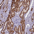Immunohistochemical staining of human kidney shows strong granular cytoplasmic positivity in cells in tubules.