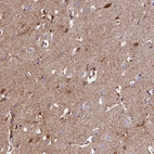Immunohistochemical staining of human cerebral cortex shows moderate positivity in neuropil.