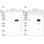 Western blot analysis using Anti-ABAT antibody HPA041528 (A) shows similar pattern to independent antibody HPA041690 (B).