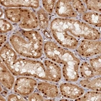 Anti-ANKRD24 Antibody