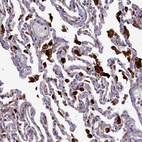 Anti-MAN2B1 Antibody