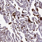 Anti-MAN2B1 Antibody