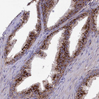 Immunohistochemical staining of the human prostate shows strong cytoplasmic granular positivity in glandular cells.