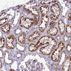 Immunohistochemical staining of the human kidney shows strong cytoplasmic granular positivity in cells in tubules.