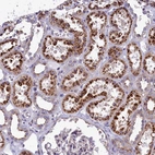 Immunohistochemical staining of the human kidney shows strong cytoplasmic granular positivity in cells in tubules.
