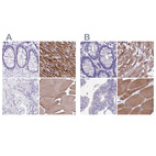 Immunohistochemical staining of human colon, heart muscle, prostate and skeletal muscle using Anti-SRL antibody HPA041535 (A) shows similar protein distribution across tissues to independent antibody HPA045520 (B).