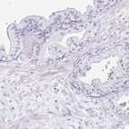 Immunohistochemical staining of human prostate shows low expression as expected.