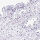 Immunohistochemical staining of human prostate shows low expression as expected.