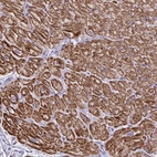 Immunohistochemical staining of human heart muscle shows high expression.