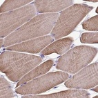 Immunohistochemical staining of human skeletal muscle using Anti-SRL antibody HPA041535.