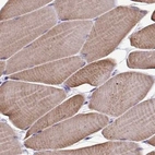 Immunohistochemical staining of human skeletal muscle using Anti-SRL antibody HPA041535.